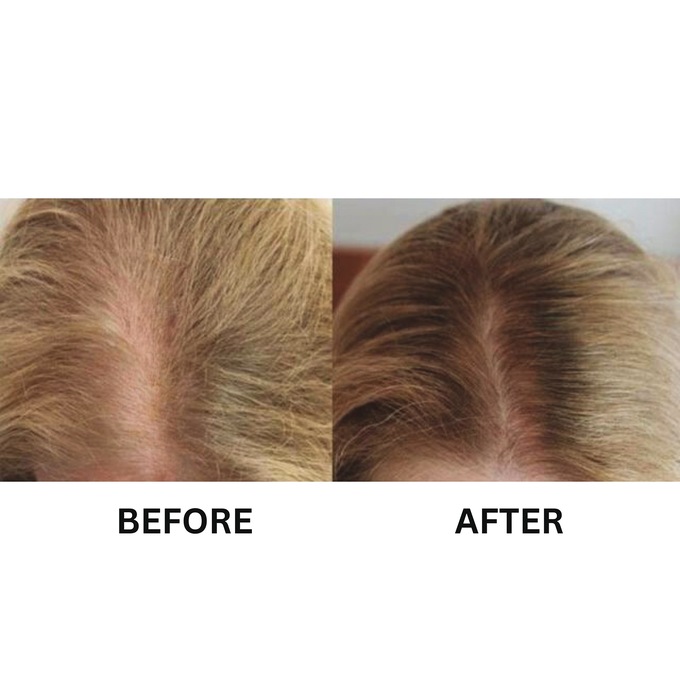 Miracle Hair Crème, , large