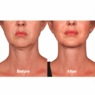 Neck Firming Cream , , large