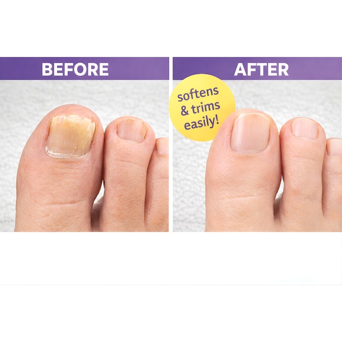 Foot Miracle Toenail Softening Cream, White, large