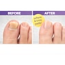 Foot Miracle Toenail Softening Cream, White, large