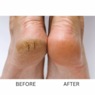 Foot Miracle Cracked-Heel Cream, , large