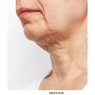 6-Pack Skin Firming Collagen & Hyaluronic Acid Chin Masks, , large