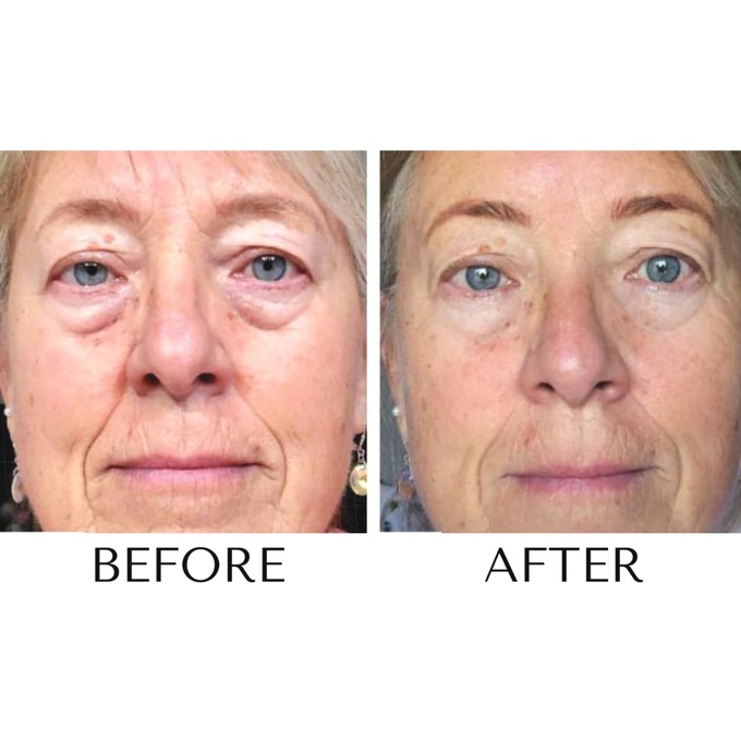 Skin Caffe Puffy Eye, Dark Circle Eye Cream, , large