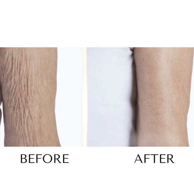 Crepe Skin Miracle Upper Arm Firming Cream, , large