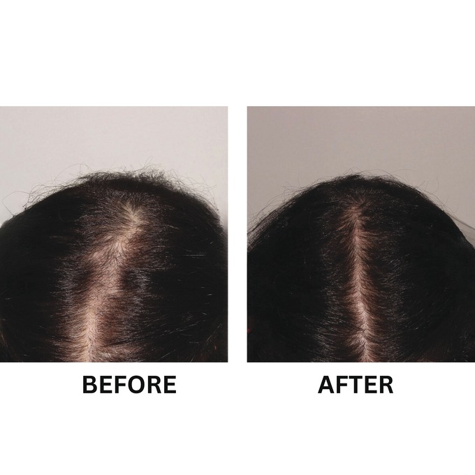 Miracle Hair Crème, , large