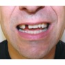 Instant Smile, , large